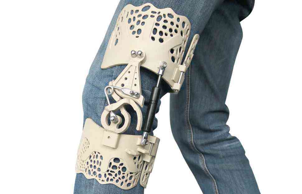 BioNEEK, un exosquelette imprimé en 3D pour réduire les douleurs du genou