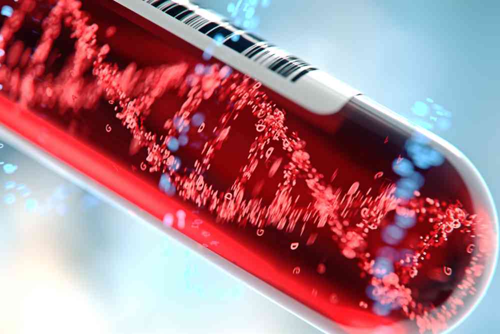 Ce test de dépistage du cancer par prise de sang ne demande que 10 minutes