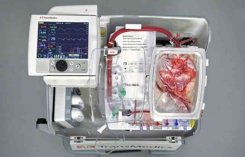 Cette machine permet de garder un cœur "vivant" pendant son transport, jusqu'à sa transplantation