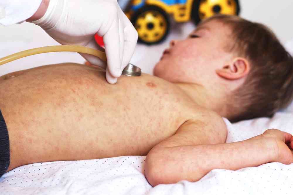 Les français "champions du monde" de l'anti-vaccination