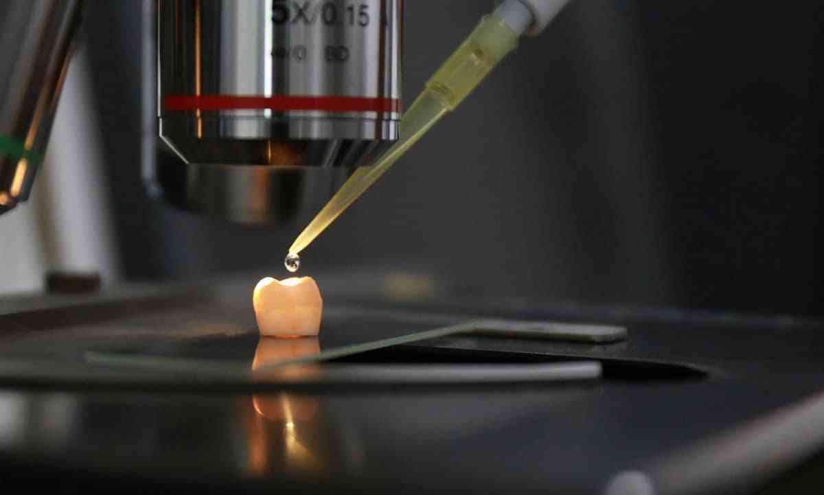 Des chercheurs ont mis au point un gel qui régénère l’émail des dents