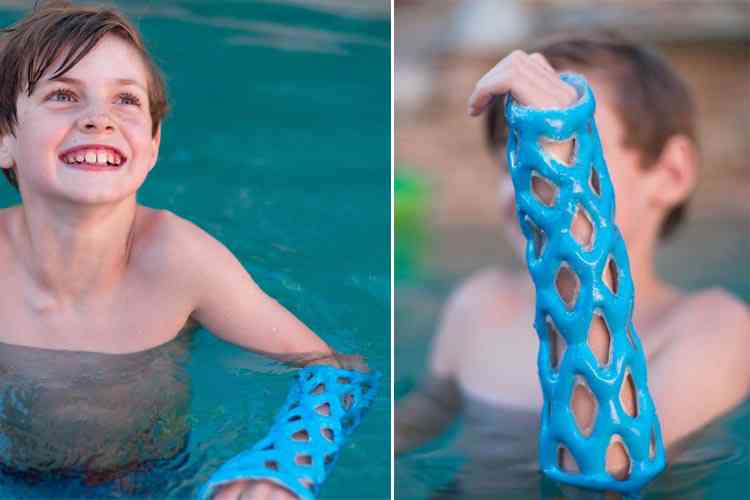 Un enfant qui nage dans une piscine avec un appareil d'immobilisation d'une fracture. L'appareil est léger, imperméable et respirant. 