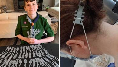 Un jeune canadien de 12 ans invente un protège-oreilles imprimable en 3D pour soulager la douleur des soignants qui portent des masques toute la journée