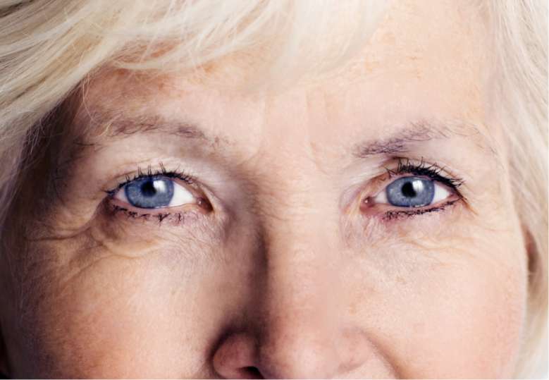 Une seule injection de cellules oculaires pour soigner la DMLA (dégénérescence maculaire liée à l'âge)