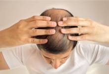 Thaïlande : des scientifiques affirment avoir découvert un remède pour lutter contre la perte des cheveux !