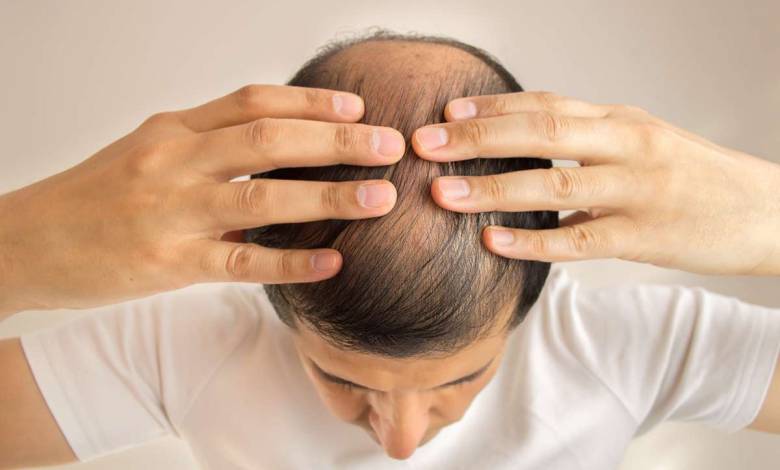 Thaïlande : des scientifiques affirment avoir découvert un remède pour lutter contre la perte des cheveux !