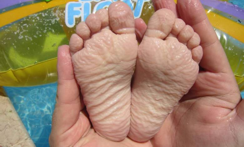 Pourquoi la peau de nos mains et de nos pieds devient-elle toute ridée et fripée avec l'eau ?