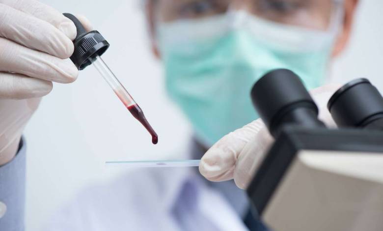 Un test sanguin pour détecter les signes de la dépression