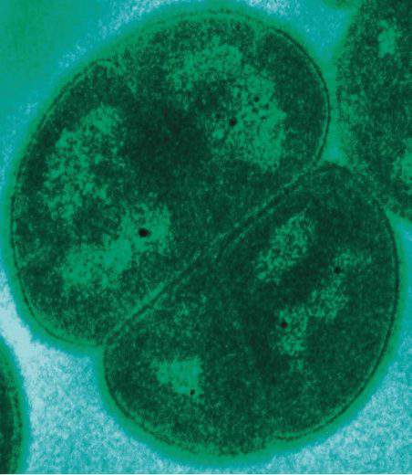 Conan : le microbe qui résiste aux radiations