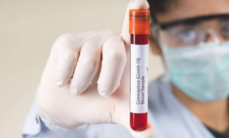 Deux études scientifiques expliquent qu'en fonction de notre groupe sanguin, nous ne serions pas tous égaux face au COVID 19 !