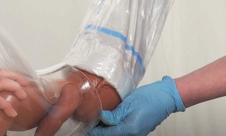 Odon : quand un mécanicien invente un dispositif obstétrique révolutionnaire pour remplacer les forceps !