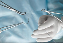 Une lycéenne de 17 ans invente un fil de suture qui change de couleur en cas d'infections
