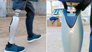 Il devient ingénieur pour se fabriquer lui-même une jambe bionique futuriste