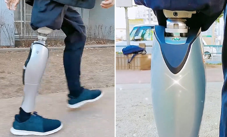 Il devient ingénieur pour se fabriquer lui-même une jambe bionique futuriste