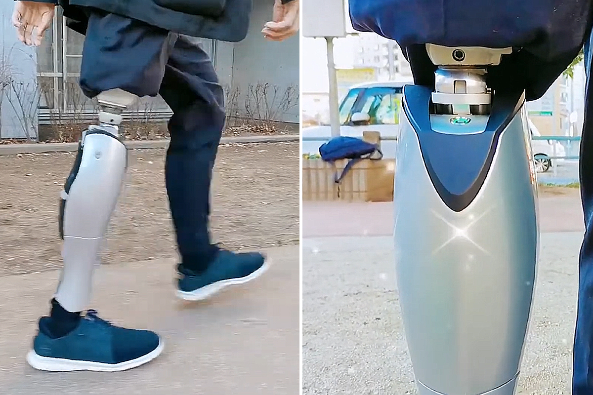 Il devient ingénieur pour se fabriquer lui-même une jambe bionique futuriste