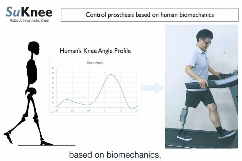 Il devient ingénieur pour se fabriquer lui-même une jambe bionique futuriste