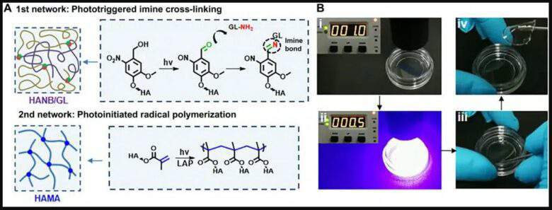 Un hydrogel révolutionnaire pour solutionner les problèmes de cartilage rapidement et sans immobilisation