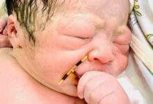 L'incroyable photo d'un bébé à peine né tenant le stérilet de sa maman dans la main