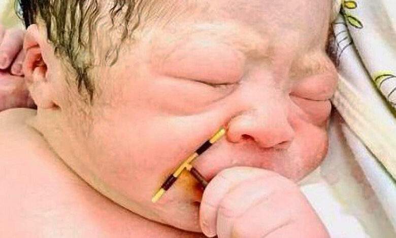 L'incroyable photo d'un bébé à peine né tenant le stérilet de sa maman dans la main
