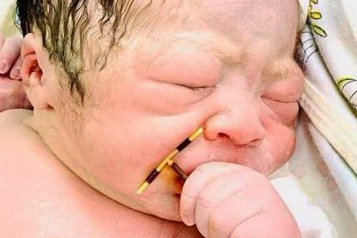 L'incroyable photo d'un bébé à peine né tenant le stérilet de sa maman dans la main