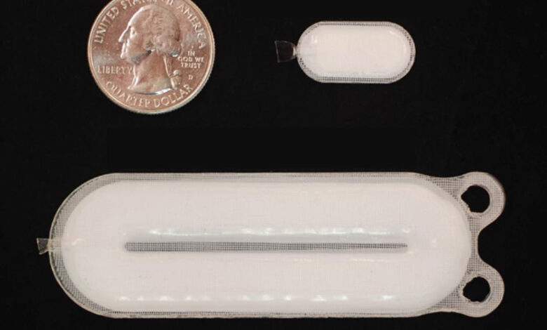 Cet implant pour lutter contre le diabète de type 1 est un espoir pour les malades