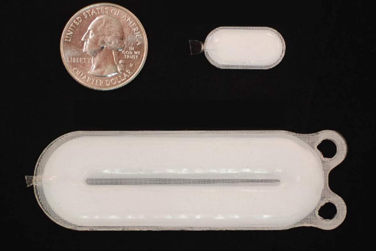 Diabète : bientôt un implant sous-cutané pour mesurer la glycémie ?