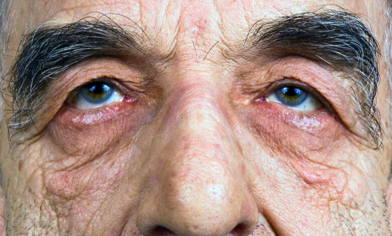 Pourquoi les sourcils des hommes deviennent ils plus broussailleux avec l’âge ?