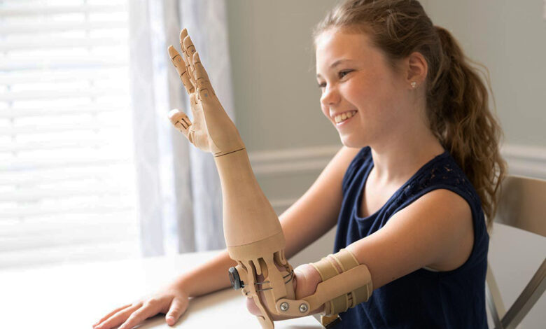 Une petite fille et sa prothèse TrueLimb