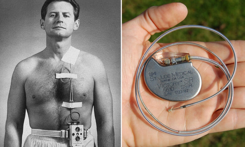 Un stimulateur cardiaque et sa sonde.
