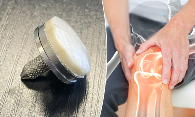 Un échantillon du nouvel hydrogel remplaçant le cartilage, attaché à une base en titane implantable.