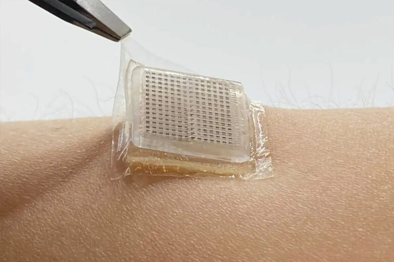 Des chercheurs inventent un patch à ultrasons fabriqué avec un hydrogel à base d'eau