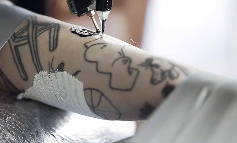 Une imprimante 3D modifiée pour lui permettre de tatouer grâce à une aiguille.