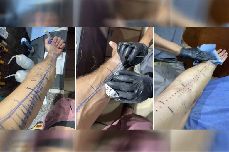 « Mon premier (et dernier) tatouage représente le temps qu'il me reste à vivre »