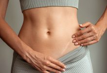 Comment faire disparaitre une cicatrice ?
