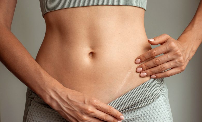 Comment faire disparaitre une cicatrice ?