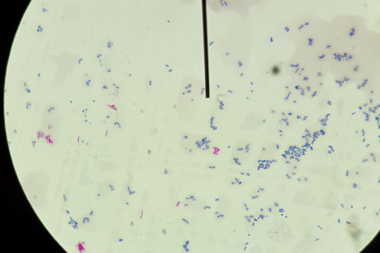 Mycobacterium smegmatis est une espèce bactérienne acido-résistante du phylum Actinobacteria et du genre Mycobacterium.