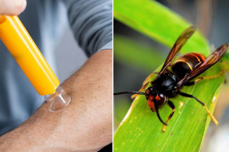 Piqûre de frelon asiatique quels sont les dangers, comment réagir ? NeozOne