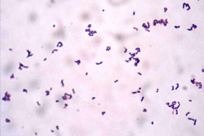 Actinomycetes, coloration de Gram d'Actinobaculum shaalii