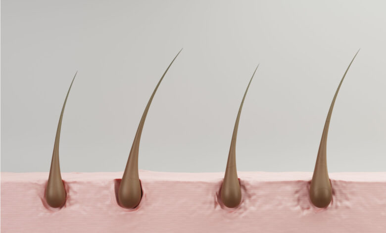 Des scientifiques impriment en 3D des follicules pileux dans une peau cultivée en laboratoire