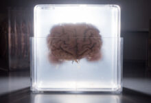 Un cerveau séparé de son corps est maintenu en vie grâce à un EPCC