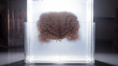 Un cerveau séparé de son corps est maintenu en vie grâce à un EPCC