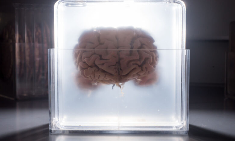 Un cerveau séparé de son corps est maintenu en vie grâce à un EPCC