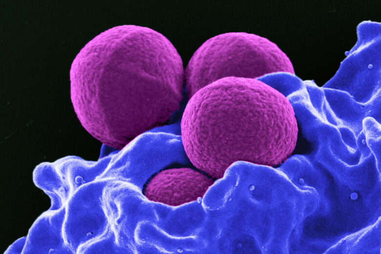 Image colorisée microscopique d'un globule blanc absorbant des corps étrangers pour la phagocytose.