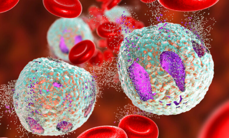 Diapositive de microscope montrant des cellules lymphoblastiques (ALL) aigües, un type de cancer du sang. Concept médical et scientifique avec analyse détaillée des cellules cancéreuses.