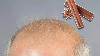 Des chercheurs auraient trouvé un moyen de faire repousser les cheveux avec la cannelle.