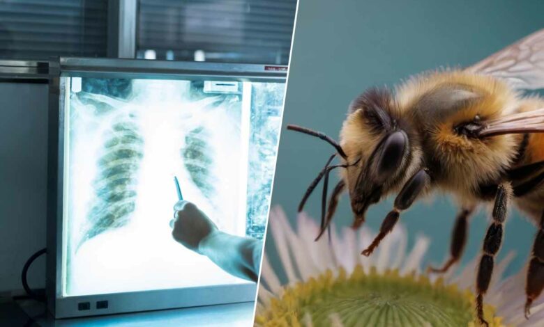 Les abeilles seraient capables de déceler un cancer des poumons.