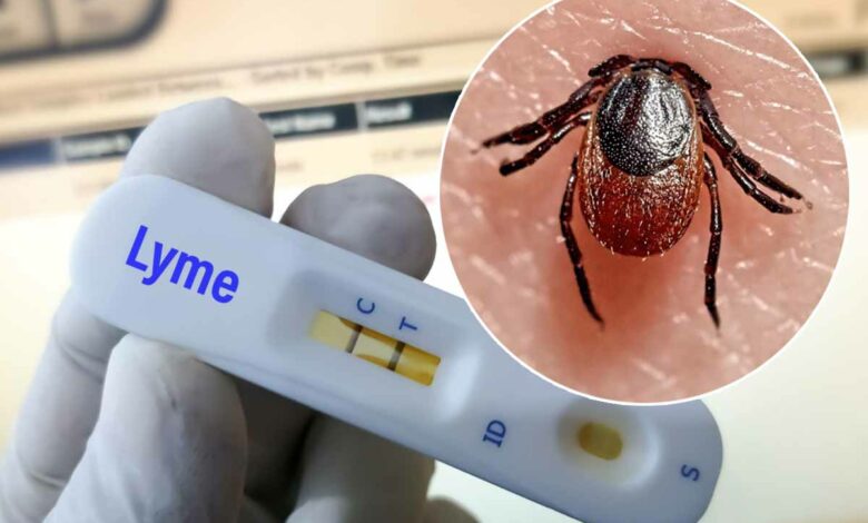 Êtes-vous porteur de la maladie de Lyme sans le savoir ?