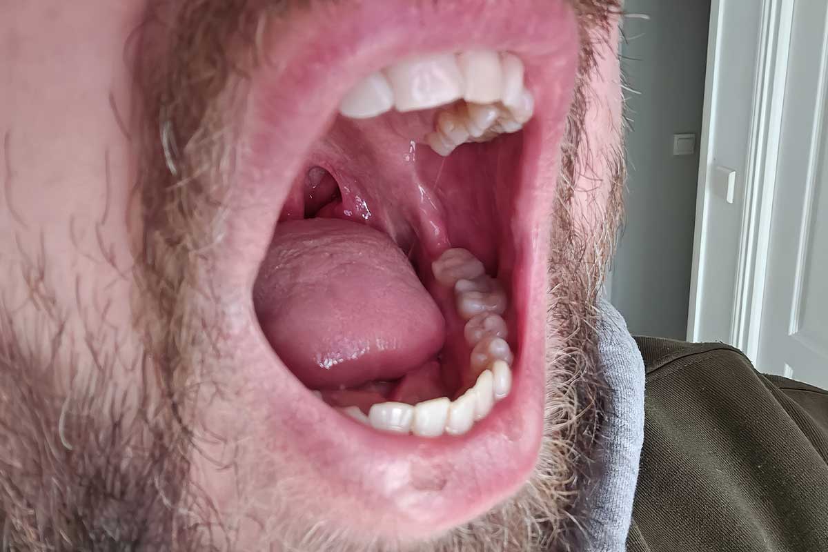 Le brossage des dents est important pour la santé bucco-dentaire afin d'éviter l'apparition de caries. Photo d'illustration non contractuelle. Crédit photo : A. Bonazzi pour NeozOne
