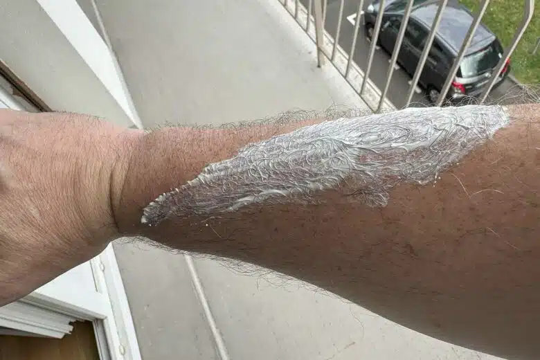Application de crème solaire.