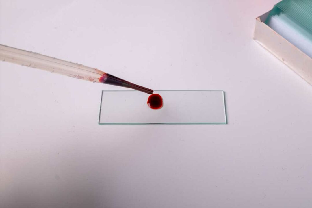Une goutte de sang en laboratoire.